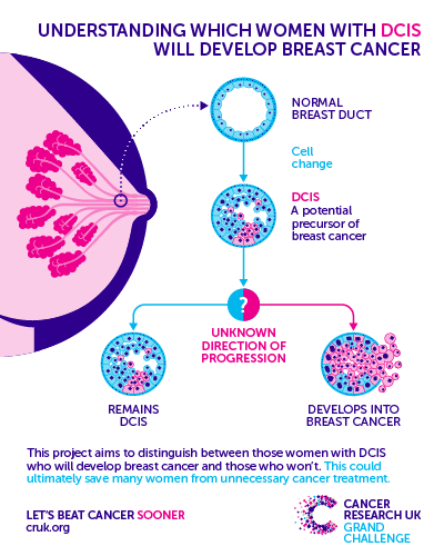 breast cancer research trust uk Breast cancer research trust uk